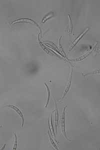 BPR_17. Zarodniki Fusarium equiseti